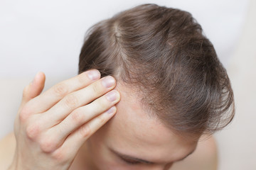 a man is checking his hair for loss. hair loss