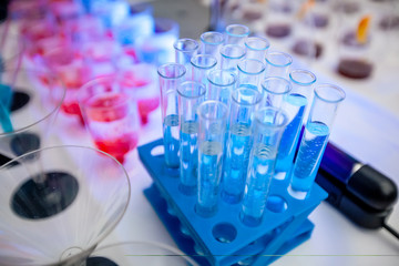 test tubes with liquid in laboratory