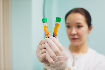 Preparing for Plasmolifting. Blood tubes in two layers divided by centrifuge after. cosmetic...