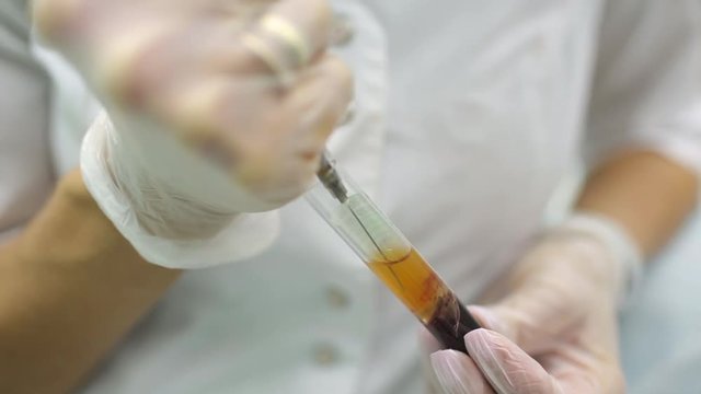 Set of preparation of blood plasma from the test tube in a syringe of blood plasma.