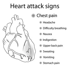 Heart attack signs, symptoms. Myocardial infarction. Damaged heart muscle. Medical, anatomical flat outline illustration.