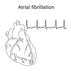 Human heart. Atrial fibrillation. Anatomy flat illustration. Outline image, white background. Heartbeat, pulse.