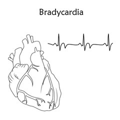 Human heart. Bradycardia. Anatomy flat illustration. Outline image, white background. Heartbeat, pulse.
