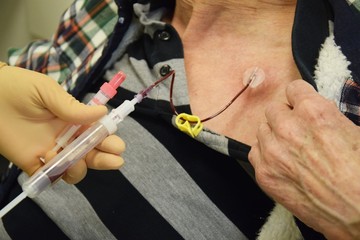 Blutabnahme vor einer Chemotherapie durch einen Port an der Brust eines alten Mannes