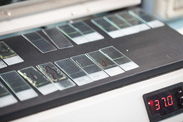 The study parasite or worms is a freshwater fish parasite in laboratory for education.