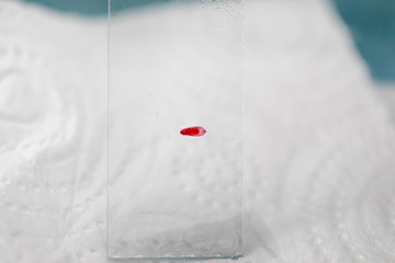 The study parasite or worms is a freshwater fish parasite in laboratory for education.