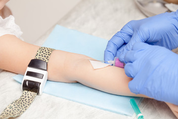 Nurse takes a blood sample from little girls arm - pediatric venipuncture  procedure