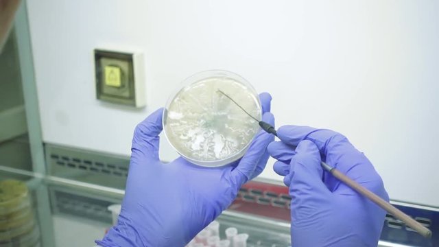 Close-up of a sample selection. Microbiological laboratory work. The real work in labortory. Selection of bacteria for analysis from a Petri dish.