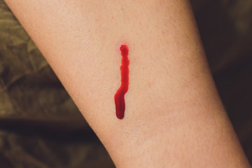 An injection. Treatment. Human blood. Blood disease. Donor. Red blood flows from the wound. A bite...