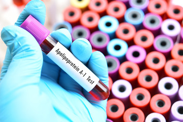 Blood sample tube for apolipoprotein A1 test

