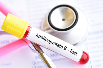 Blood sample tube for apolipoprotein B test
