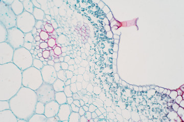 Plant vascular tissue under microscope view.