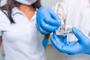 Dentist showing the client the layout of the jaw in the dental clinic inserting teeth on implants close-up