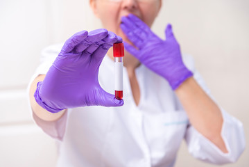 Scared woman holding blood sample tube