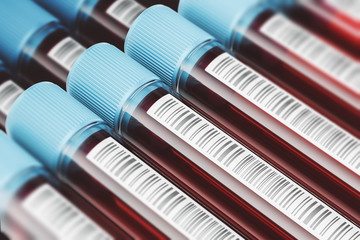 Diagonal test tubes with blood
