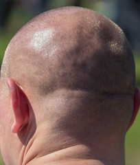 Naklejka premium Head of a bald man as background