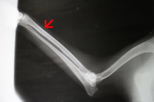 X-ray picture of fissure on radius by dog