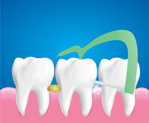 Dental Floss Picks, Dental Cleaning Tool, Dental care concept, Illustration Vector