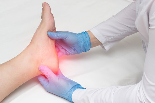 Doctor examines the leg of the woman’s heel for heel spurs, pain in the foot, plantar fasciitis, osteophyte