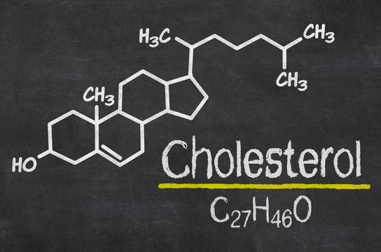 Blackboard with the chemical formula of cholesterol