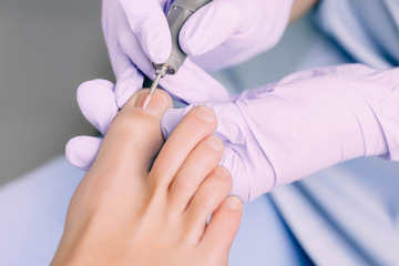 Podiatrists making procedure polish toenail,pedicure treatment with special tool.