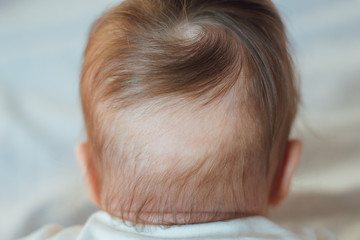 Bald spot at the back of baby's head 