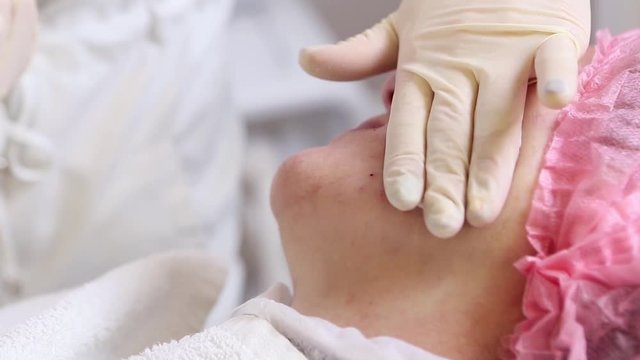 Aged woman doing mesothreads and Thread Lifting, Cosmetology. Cosmetic procedure to eliminate signs of aging. Beauty Face, Facial contour, plastic surgery concept for Age 40-50 years