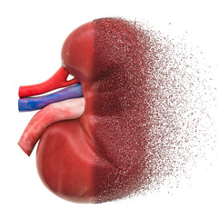 Chronic kidney disease, kidney failure concept. 3D rendering