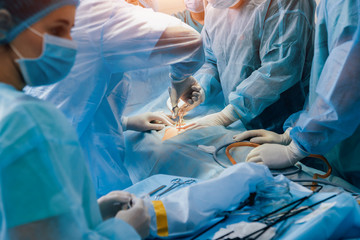 Process of gynecological surgery operation using laparoscopic equipment. Group of surgeons in operating room with surgery equipment