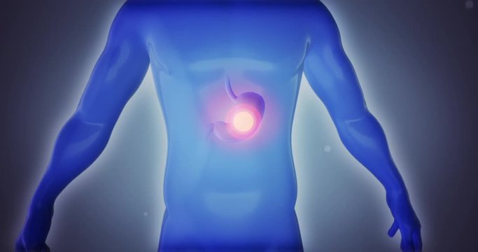 3D anatomy man suffering stomach diseases, infection, gastritis, stomach cancer, nausea, vomiting, bloating, cramps, diarrhea and pain from ton a dramatic background. Video a great for medical purpose