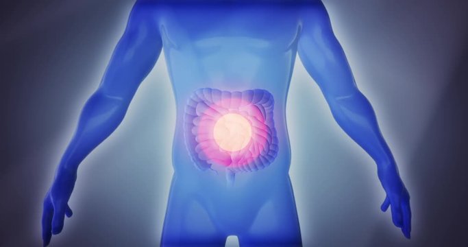 3D anatomy man suffering from intestine inflammatory bowel Disease, small intestine and large intestine pain, celiac, infections or cancer on a dramatic background. Video a great for medical purpose