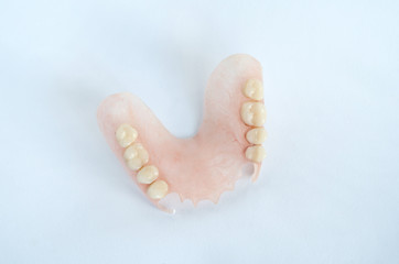 The upper part of the partial denture. Dental prosthetics.