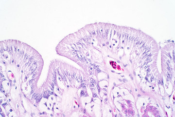 Human large intestine tissue under microscope view