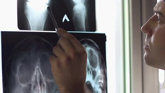 Doctor looks at a man's x-ray