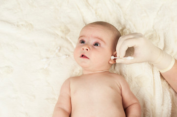 The child at the doctor's office and his ears are cleaned with a cotton swab.