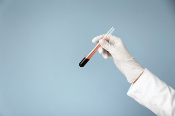Hand of laboratory assistant holding test tube with blood sample on color background