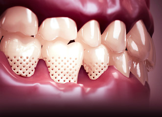 Bocca, denti, gengive. Denti sensibili, ritiro della gengiva. Sensibilità dentale. Laboratorio dentistico. 3d rendering © Naeblys