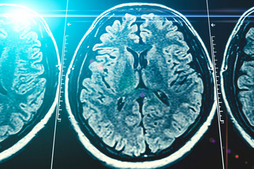 Mri brain scan background, magnetic resonance  tomography, with blue light effect