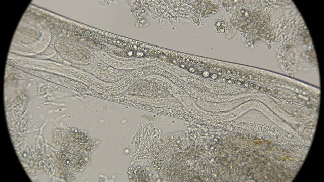 young nematodes inside the female acetic eel Turbatrix aceti, which are viviparous nematodes, under a microscope 4K