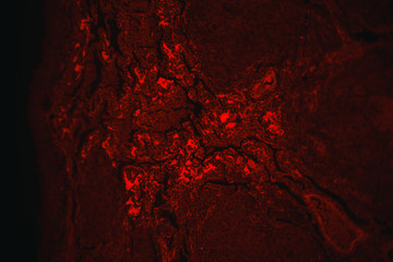 tuberculoid granuloma of hunman