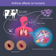 Anthrax effects on humans it can cause death.