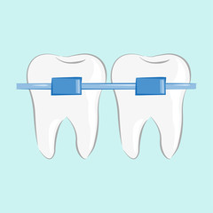 Teeth braces in flat style, vector illustration