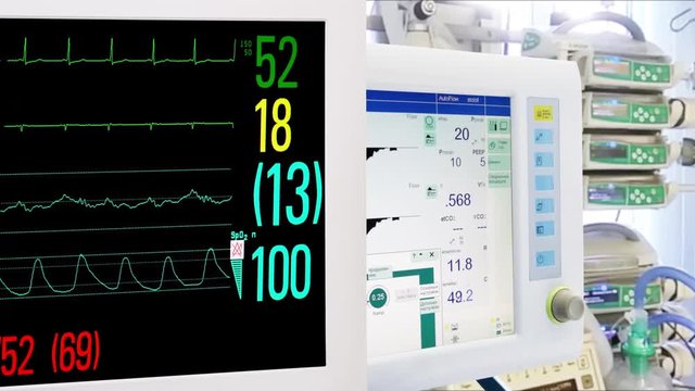 Medical Equipment in ICU. Cardiac and Vital Sign Monitoring, Mechanical Lung ventilation