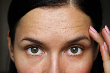 deep forehead wrinkles