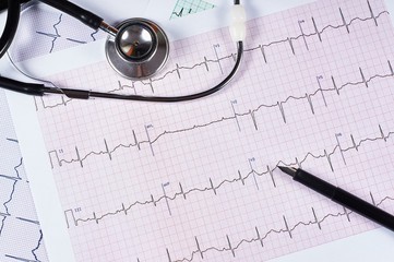 Electrocardiogram EKG graph paper, stethoscope and pen, Close-up.
