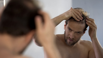 Middle-aged man looking in mirror at his bald patches, hair loss problem