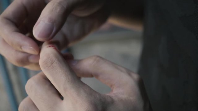 Man cut himself with a knife in accident, causing a minor bleeding wound