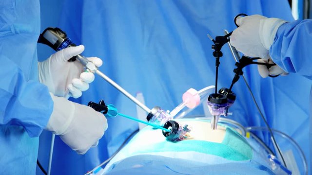 Professional hospital specialist team in scrubs in the operating theatre performing laparoscopic surgery using video monitor playback and Endoscope and Laparoscope instruments 