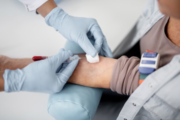 Careful doctor collecting blood sample from the arm of his patient and using vacuum collection needle