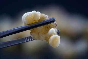 Frankincense resin is coarse-grained to lumpy and of translucent brown-yellow to reddish-brown...